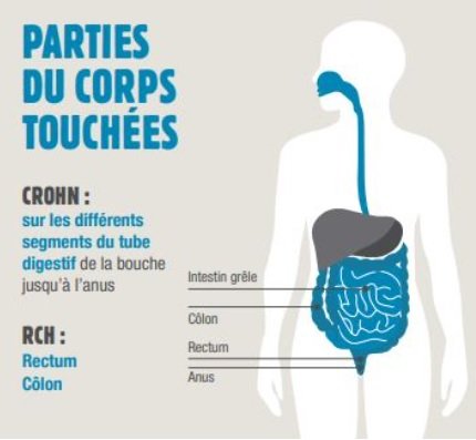 mici parties du corps touchées